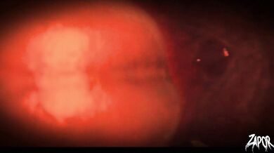 Monster [Eat]: Vore is a sexual fetish where one person consumes the other in a way that simulates eating or swallowing them whole.