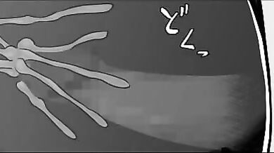 Z-Type Ejaculation Management Android