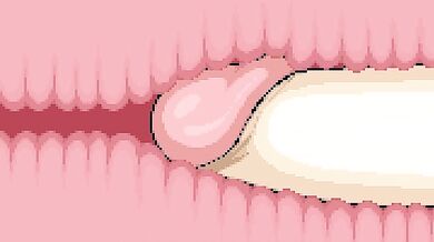 Linc & Co. [with Added Sound Effects]