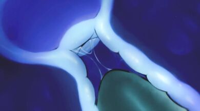 The Tentacular Love of exv508