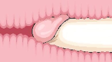 Reminiscences of C*A*T*F*I*S*