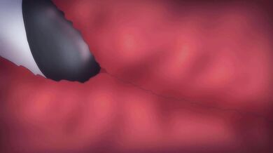 Silent Hunter: Huntress vs. Beetleman