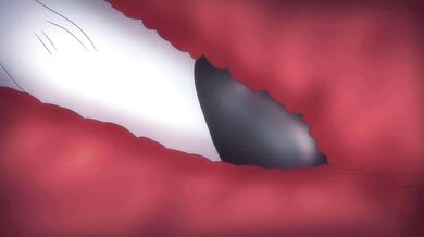 Silent Hunter: Huntress vs. Beetleman