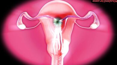 X-Ray Tentacle Invasion: Tifa's Womb Conquest