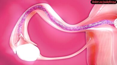 Stretching Tifa's Swamp with X-ray Tentacles