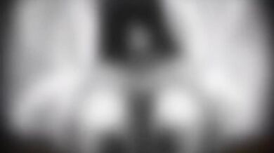 The Ring of Anal Sex
