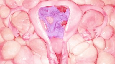 The Green Spider's Racoon